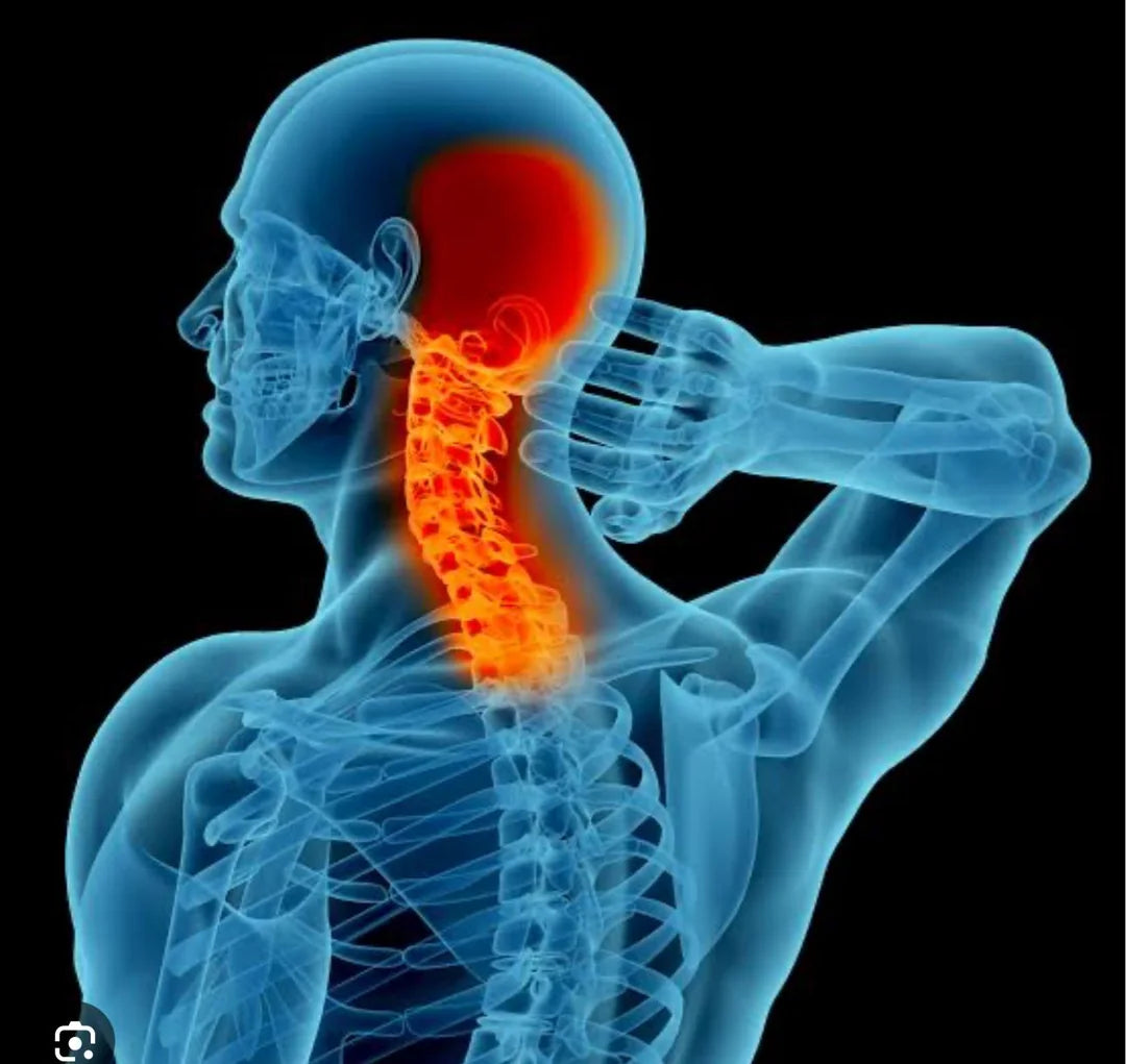Why Does The Pain ALWAYS Start at the Base of My Skull and